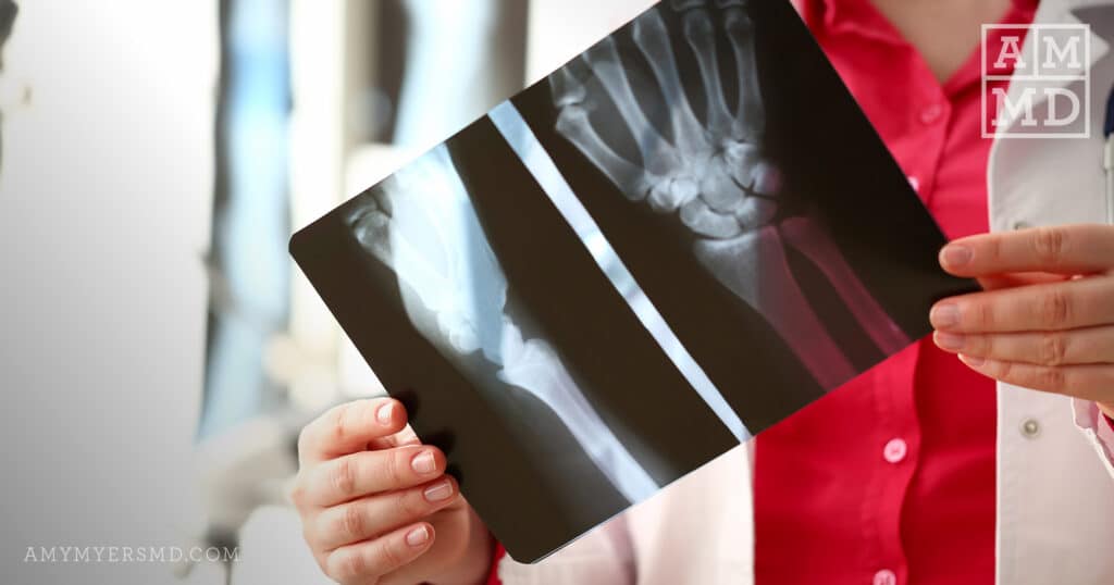 4 Essential Supplements Everyone Should Take Amy Myers MD