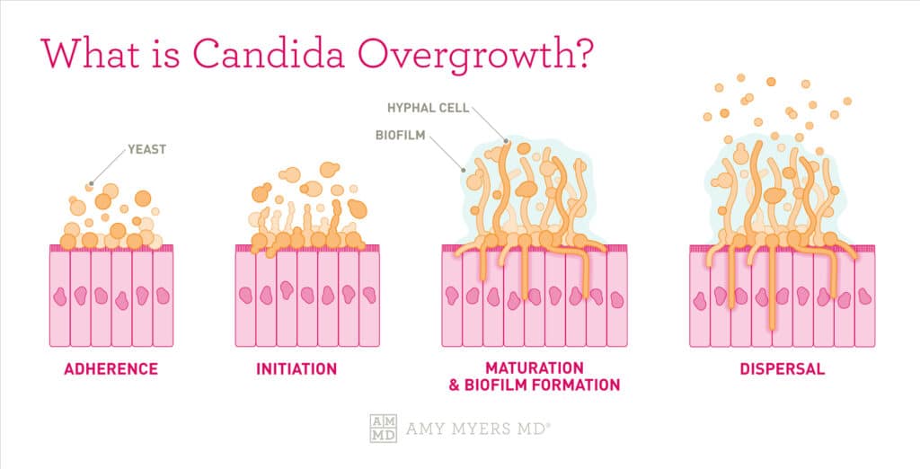 candida in stool die off