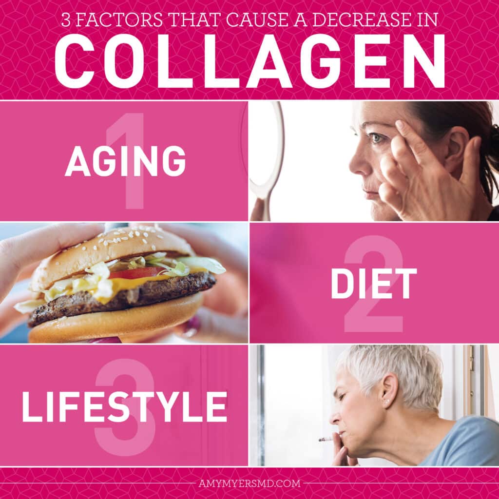 3 Factors That Cause A Decrease In Collagen - Infographic - Amy Myers MD®