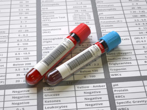 Two medial vials of blood for bloodwork.