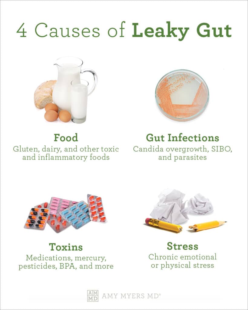 4 Causes Of Leaky Gut - Infographic - Amy Myers MD®