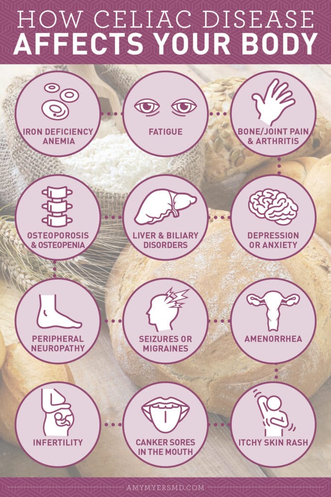 How Celiac Disease Affects Your Body - Infographic - Amy Myers MD®