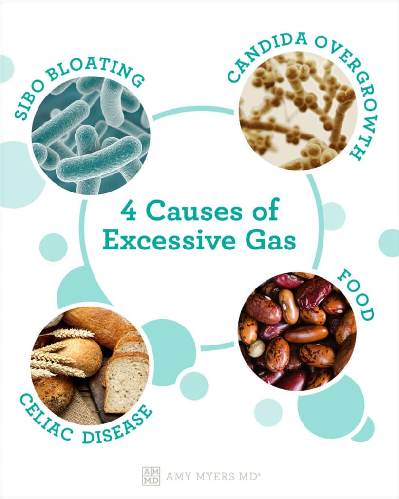 Why causes gas - infographic - Amy Myers MD®