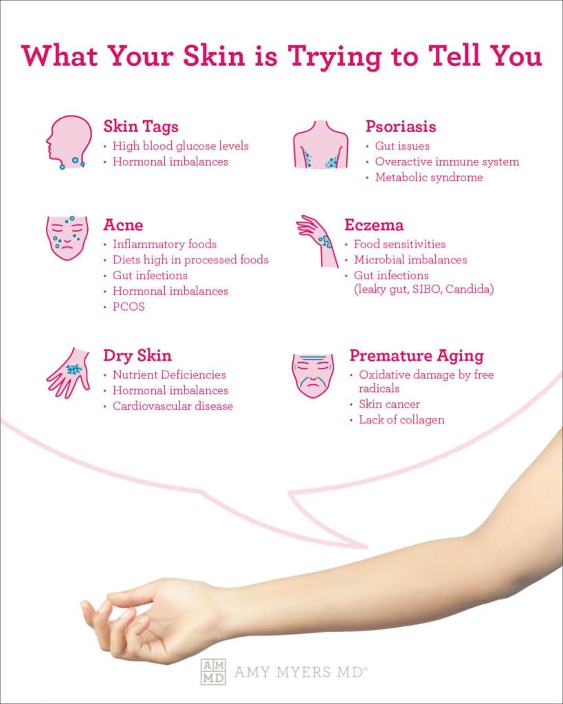 What Your Skin Is Trying To Tell You About Your Health- Infographic - Amy Myers MD®