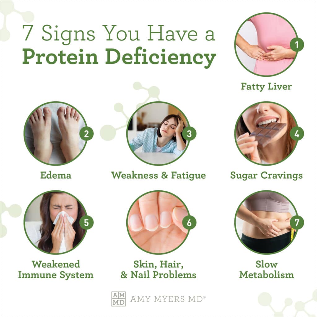 What is hypoproteinemia - infographic - Amy Myers MD®