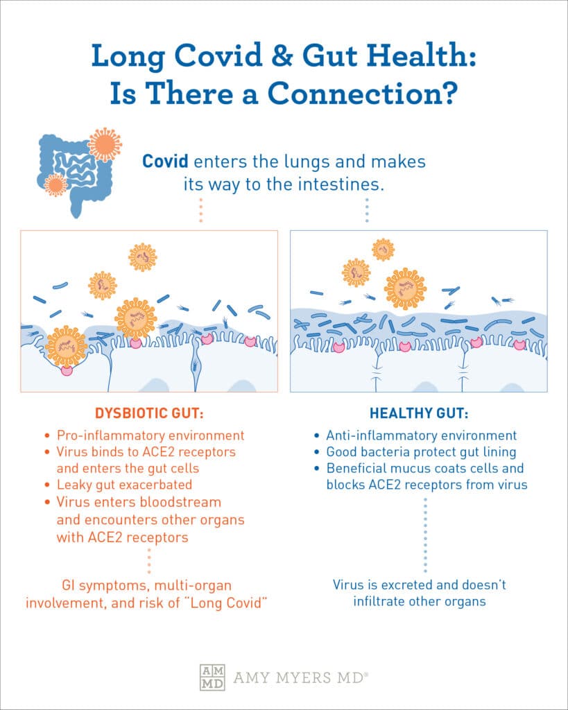 the-long-covid-digestive-symptoms-connection-amy-myers-md