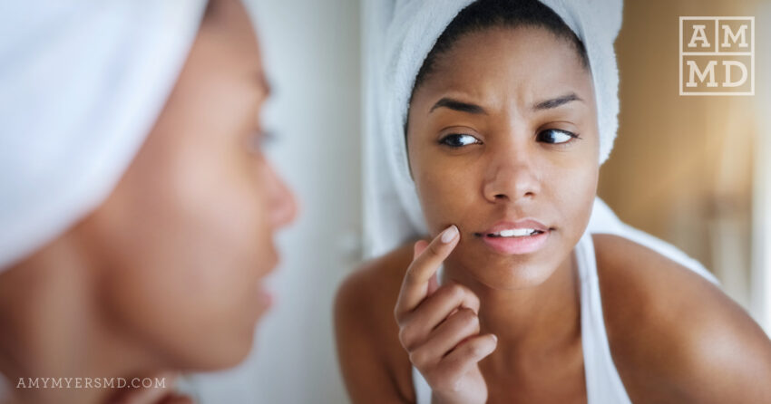 Gut Health and Hormones: What’s Really Causing Your Hormonal Imbalance?